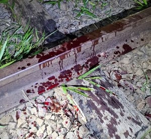 Homem é preso após esfaquear suspeito de furto; vítima segue internada em estado grave