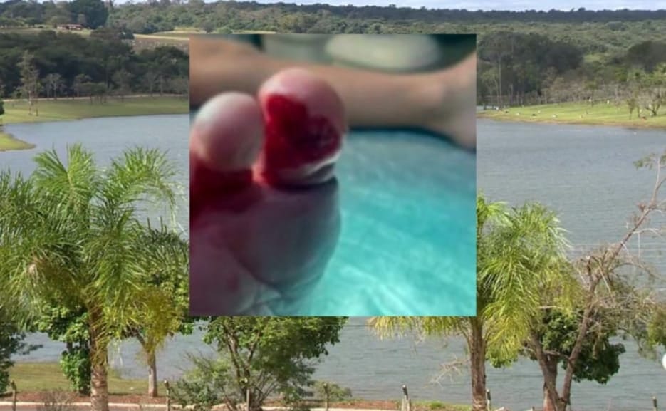 Criança de 4 anos é ferida por piranha em balneário de Rancharia; local não tinha salva-vidas nem placas de alerta