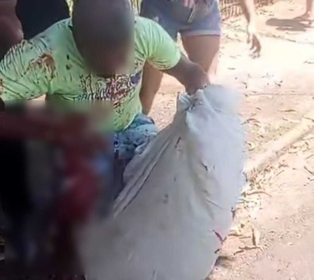 Idoso é atacado por pitbull no centro de Tarabai e encaminhado ao Hospital Regional